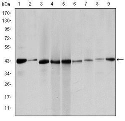 alpha-Smooth Muscle Actin Antibody (1H8), Novus Biologicals:Antibodies:Primary