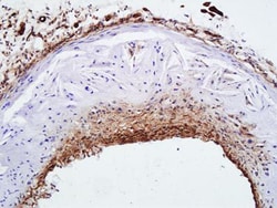 alpha-Smooth Muscle Actin Antibody (4A4), Novus Biologicals 0.025mL; Unlabeled:Antibodies,