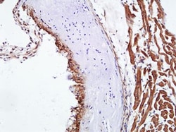 alpha-Smooth Muscle Actin Antibody (4A4), Novus Biologicals 0.025mL; Unlabeled:Antibodies,