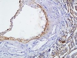 alpha-Smooth Muscle Actin Antibody (4A4), Novus Biologicals 0.025mL; Unlabeled:Antibodies,