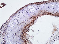 alpha-Smooth Muscle Actin Antibody (4A4), Novus Biologicals 0.025mL; Unlabeled:Antibodies,