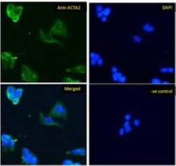 alpha-Smooth Muscle Actin Antibody, Novus Biologicals 0.1mg; Unlabeled:Antibodies,