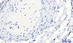 alpha-Smooth Muscle Actin Antibody, Novus Biologicals 0.1mg; Unlabeled:Antibodies,