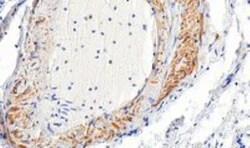 alpha-Smooth Muscle Actin Antibody, Novus Biologicals 0.1mg; Unlabeled:Antibodies,
