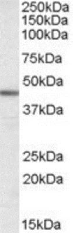 alpha-Smooth Muscle Actin Antibody, Novus Biologicals 0.1mg; Unlabeled:Antibodies,