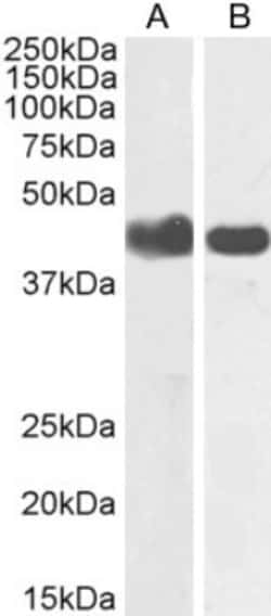 alpha-Smooth Muscle Actin Antibody, Novus Biologicals 0.1mg; Unlabeled:Antibodies,