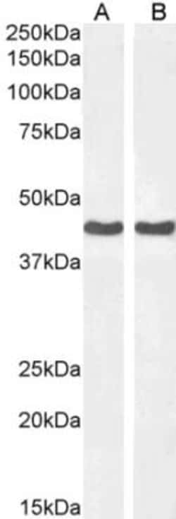alpha-Smooth Muscle Actin Antibody, Novus Biologicals 0.1mg; Unlabeled:Antibodies,