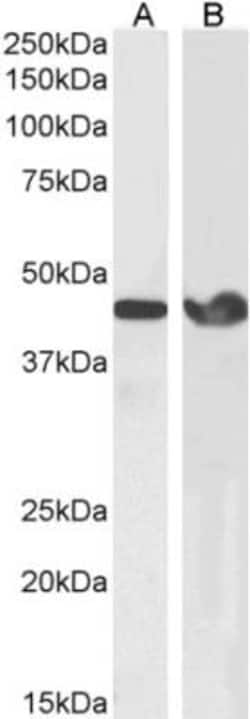 alpha-Smooth Muscle Actin Antibody, Novus Biologicals 0.1mg; Unlabeled:Antibodies,