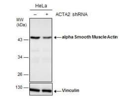 alpha-Smooth Muscle Actin Antibody, Novus Biologicals 0.1mg; Unlabeled:Antibodies,