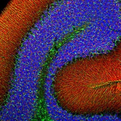 alpha-Synuclein Antibody (2A7), Novus Biologicals 0.1 mL; Unconjugated:Antibodies,