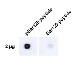 alpha-Synuclein, Cys Glu134, p Ser129 Antibody (J18), Novus Biologicals