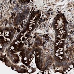 archaemetzincin-1 Antibody, Novus Biologicals 0.1mL; Unlabeled:Antibodies,
