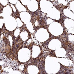 bcl10-interacting CARD protein Antibody, Novus Biologicals:Antibodies:Primary