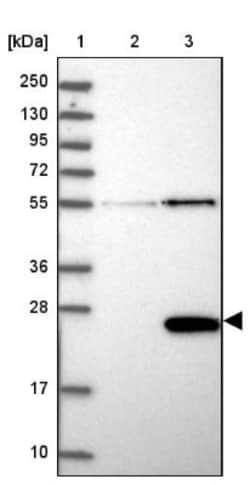 bcl10-interacting CARD protein Antibody, Novus Biologicals:Antibodies:Primary
