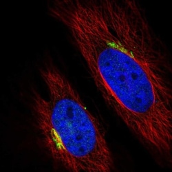 beta-1,4-Galactosyltransferase 1/B4GalT1 Antibody, Novus Biologicals:Antibodies:Primary