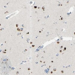 beta-1,4-Galactosyltransferase 1/B4GalT1 Antibody, Novus Biologicals:Antibodies:Primary
