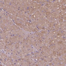 beta-1 Adrenergic R/ADRB1 Antibody, Novus Biologicals 0.1mL; Unlabeled:Antibodies,