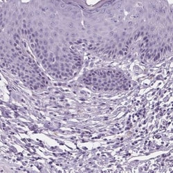 beta-1 Adrenergic R/ADRB1 Antibody, Novus Biologicals 0.1mL; Unlabeled:Antibodies,