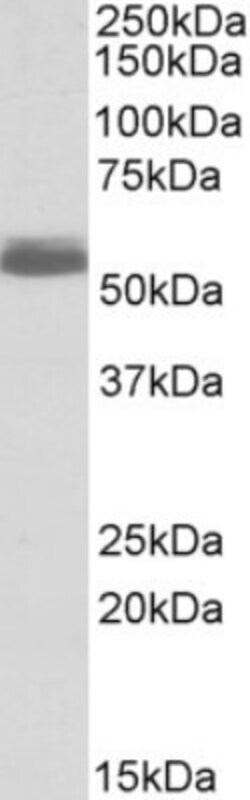 beta-1 Adrenergic R/ADRB1 Antibody, Novus Biologicals 0.1mg; Unlabeled:Antibodies,