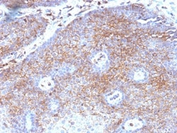 beta 2-Microglobulin Antibody (B2M/1118), Novus Biologicals 0.2mg; Unlabeled:Antibodies,