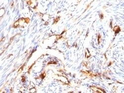 beta 2-Microglobulin Antibody (B2M/1118), Novus Biologicals 0.2mg; Unlabeled:Antibodies,
