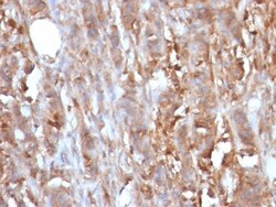 beta 2-Microglobulin Antibody (B2M/961), Novus Biologicals 0.2mg; Unlabeled:Antibodies,