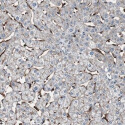 beta 2-Microglobulin Antibody, Novus Biologicals 25 &mu;L | Buy Online | Novus Biologicals | Fisher Scientific