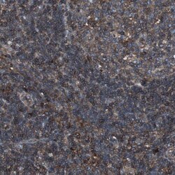 beta 2-Microglobulin Antibody, Novus Biologicals 25 &mu;L | Buy Online | Novus Biologicals | Fisher Scientific