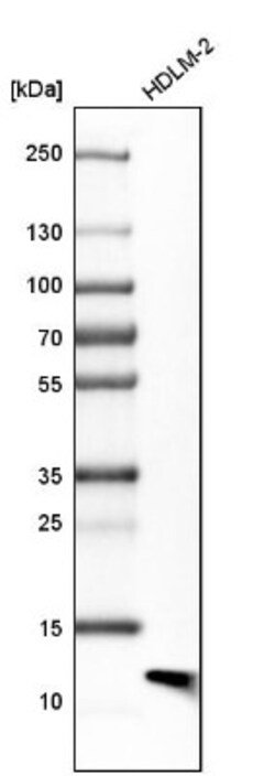 beta 2-Microglobulin Antibody, Novus Biologicals 25 &mu;L | Buy Online | Novus Biologicals | Fisher Scientific