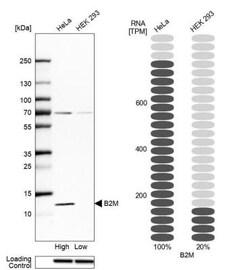 beta 2-Microglobulin Antibody, Novus Biologicals 25 &mu;L | Buy Online | Novus Biologicals | Fisher Scientific