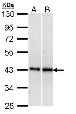 beta-3 Adrenergic R/ADRB3 Antibody, Novus Biologicals 0.1mL; Unlabeled:Antibodies,