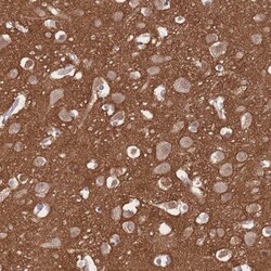beta Adducin Antibody, Novus Biologicals:Antibodies:Primary Antibodies