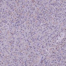 beta Adducin Antibody, Novus Biologicals:Antibodies:Primary Antibodies