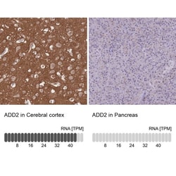 beta Adducin Antibody, Novus Biologicals:Antibodies:Primary Antibodies