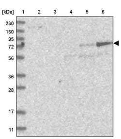 beta Adducin Antibody, Novus Biologicals:Antibodies:Primary Antibodies