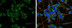 APP Antibody, Novus Biologicals 0.1mL; Unlabeled:Antibodies, Polyclonal