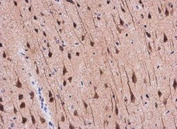 APP Antibody, Novus Biologicals 0.1mL; Unlabeled:Antibodies, Polyclonal