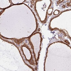 beta COP Antibody, Novus Biologicals 25 &mu;L, Unlabeled:Antibodies, Polyclonal