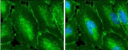 beta-Catenin Antibody, Novus Biologicals 0.1mg; Unlabeled:Antibodies, Polyclonal