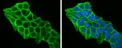 beta-Catenin Antibody, Novus Biologicals 0.1mg; Unlabeled:Antibodies, Polyclonal