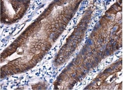 beta-Catenin Antibody, Novus Biologicals 0.1mg; Unlabeled:Antibodies, Polyclonal
