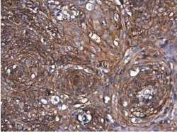 beta-Catenin Antibody, Novus Biologicals 0.1mg; Unlabeled:Antibodies, Polyclonal
