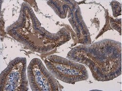 beta-Catenin Antibody, Novus Biologicals 0.1mg; Unlabeled:Antibodies, Polyclonal