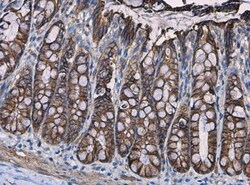 beta-Catenin Antibody, Novus Biologicals 0.1mg; Unlabeled:Antibodies, Polyclonal