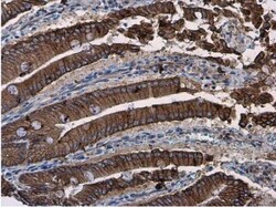 beta-Catenin Antibody, Novus Biologicals 0.1mg; Unlabeled:Antibodies, Polyclonal