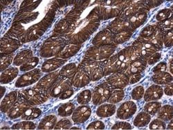 beta-Catenin Antibody, Novus Biologicals 0.1mg; Unlabeled:Antibodies, Polyclonal