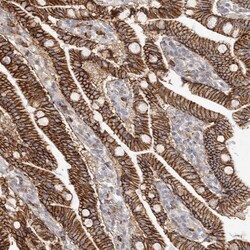 beta-Catenin Antibody, Novus Biologicals 25 &mu;L | Buy Online | Novus Biologicals | Fisher Scientific