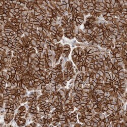 beta-Catenin Antibody, Novus Biologicals 25 &mu;L | Buy Online | Novus Biologicals | Fisher Scientific