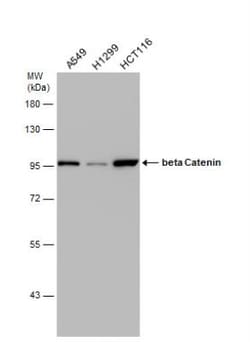 beta-Catenin Antibody, Novus Biologicals 0.1mg; Unlabeled:Antibodies, Polyclonal