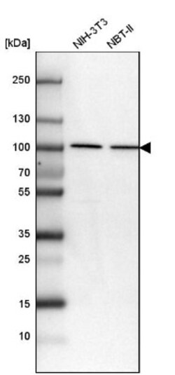 beta-Catenin Antibody, Novus Biologicals 25 &mu;L | Buy Online | Novus Biologicals | Fisher Scientific